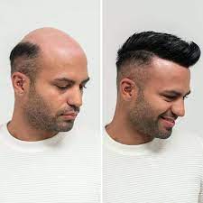 Before & After