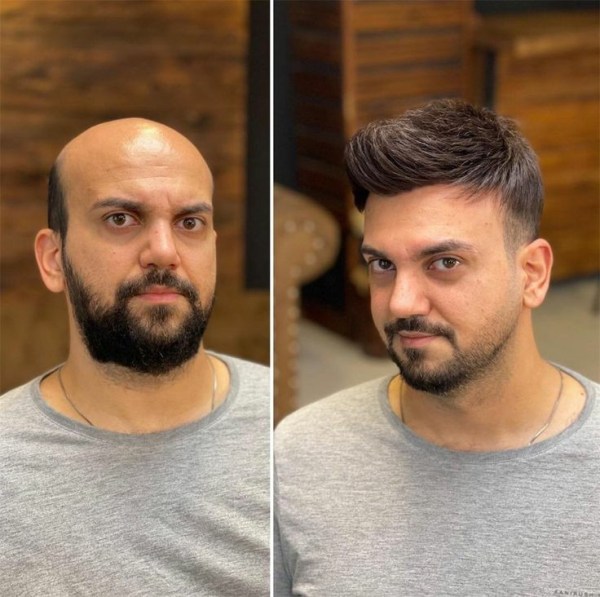 Before & After